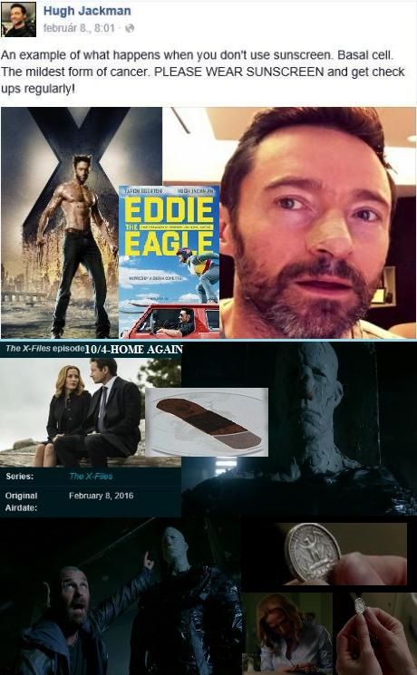 http://csillag-szeme.hupont.hu/felhasznalok_uj/2/7/273931/kepfeltoltes/hugh_jackman_es_x-aktak_-_ragtapasz_orr_es_sas.jpg?20390894